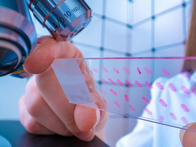 A woman in a white blouse sets a slide plate under a microscope
